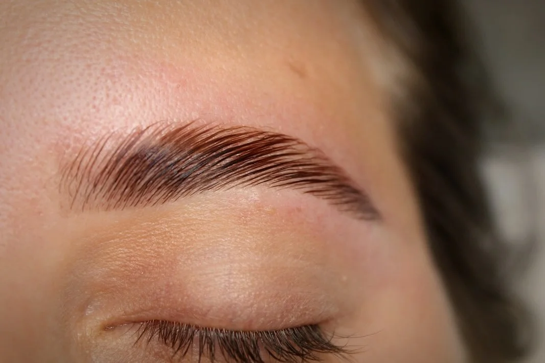 Brow lift obrva